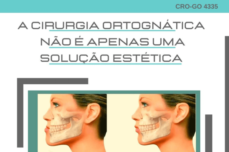 A cirurgia ortognatica não é apneas uma solução estética