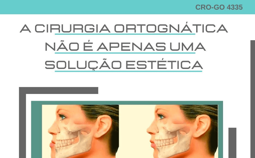 A cirurgia ortognatica não é apneas uma solução estética