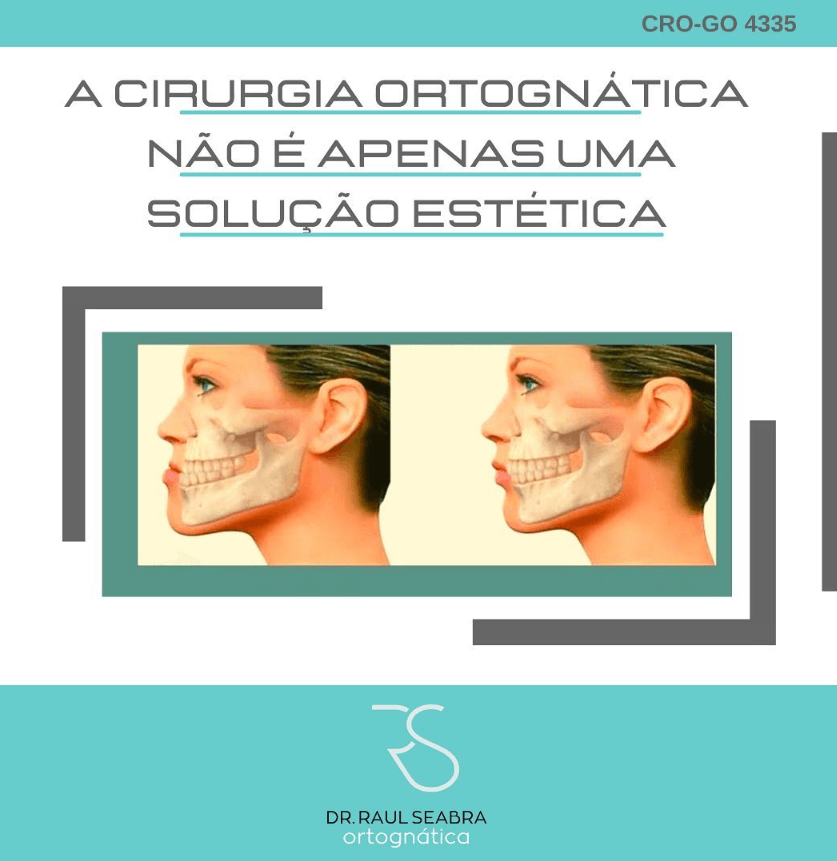 A cirurgia ortognatica não é apneas uma solução estética